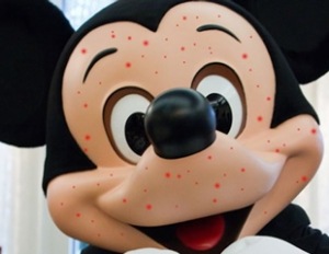 mickey-mouse-with-measles