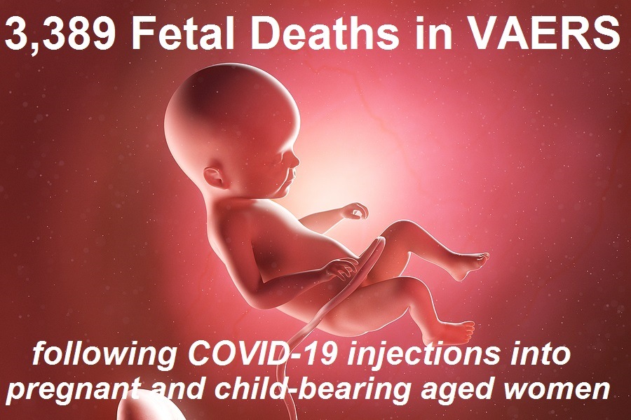 Fetal deaths vaers 1 28 | 76,253 dead 6,033,218 injured recorded in europe and usa following covid vaccines with 4,358 fetal deaths in u.s. | health