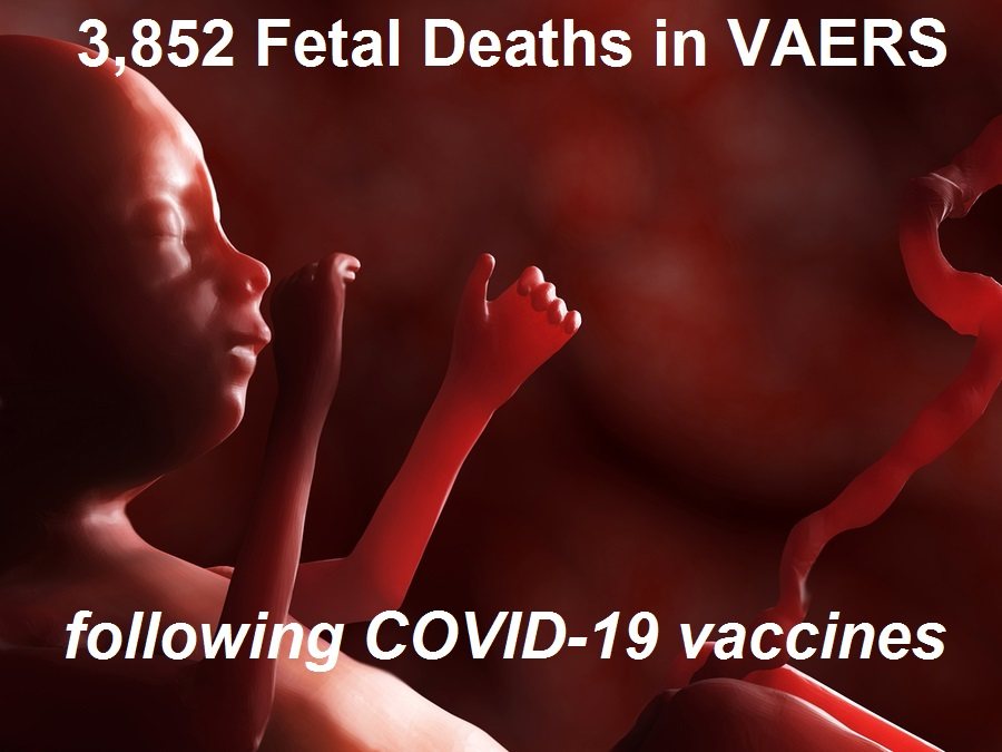 Fetal deaths 3 4 22 | 76,253 dead 6,033,218 injured recorded in europe and usa following covid vaccines with 4,358 fetal deaths in u.s. | health