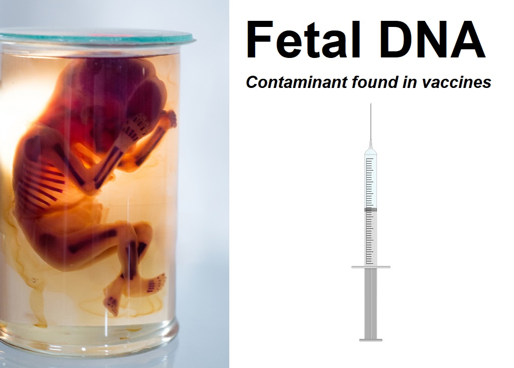 Unborn fetus in formalin solution, medical research